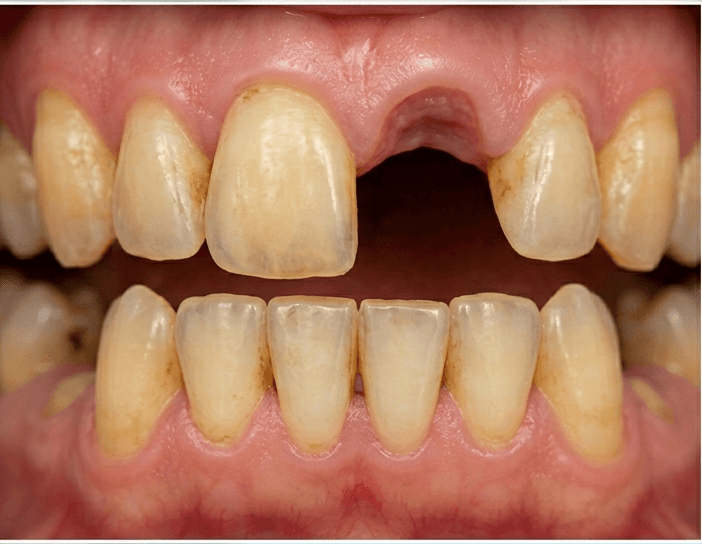 Before treatment