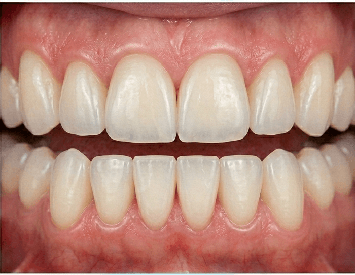 After treatment